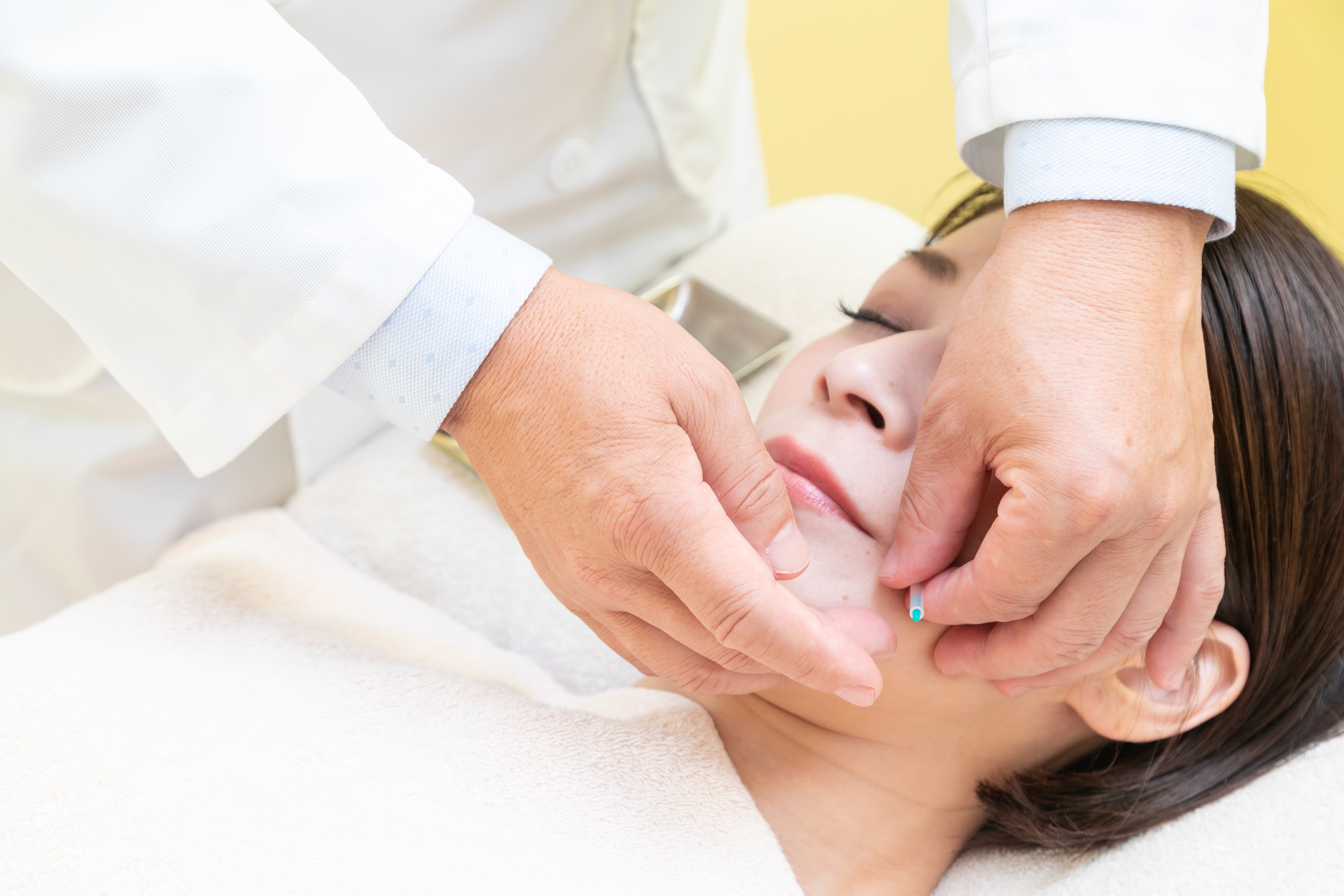 顔面神経麻痺施術特徴3